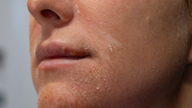 Niacinamide for Dry Skin: Benefits, Uses, and Expert Tips! Niacinamide for Dry Skin: Benefits, Uses, and Expert Tips!